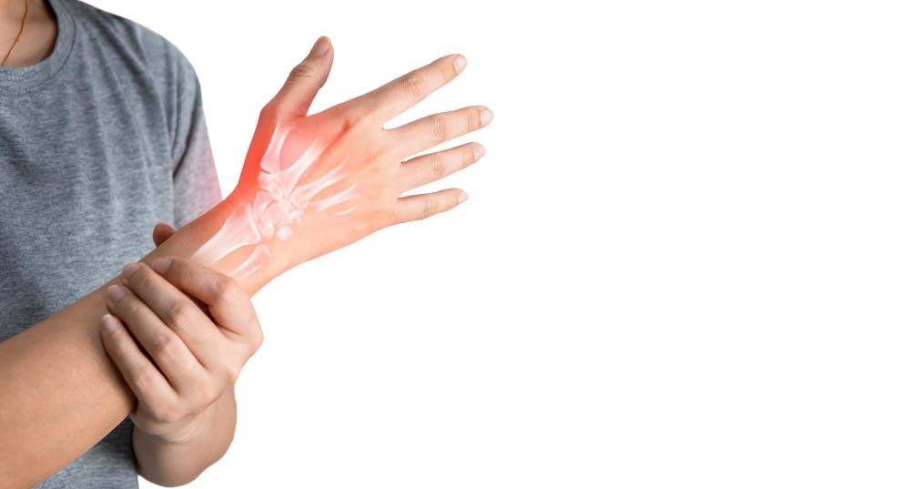 Лечение артрита рук